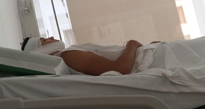 Joven brutalmente golpeado tras salir de un boliche: fractura de mandíbula y rodilla