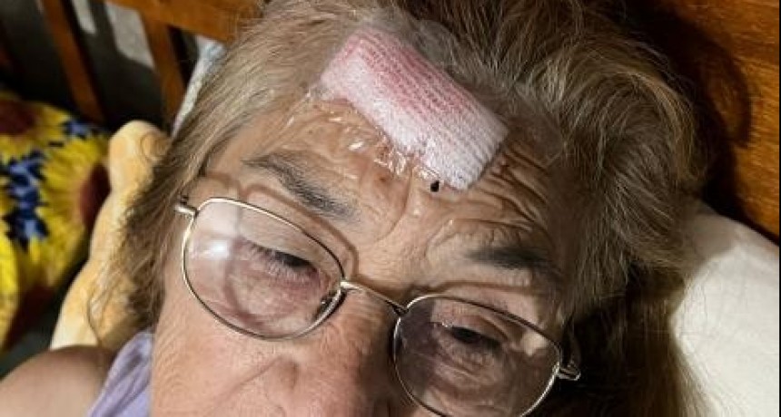 Santa Fe: Una pareja de 70 años terminó herida en un violento robo callejero