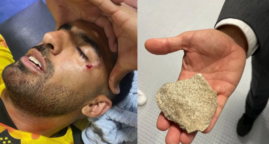 Violencia en el Gigante: Hinchas de Central hieren a jugador de Peñarol