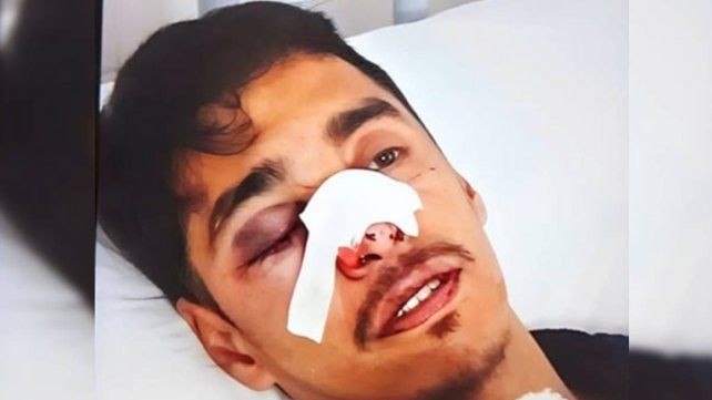 Conmoción en Entre Ríos por la violenta golpiza a un joven hipoacúsico