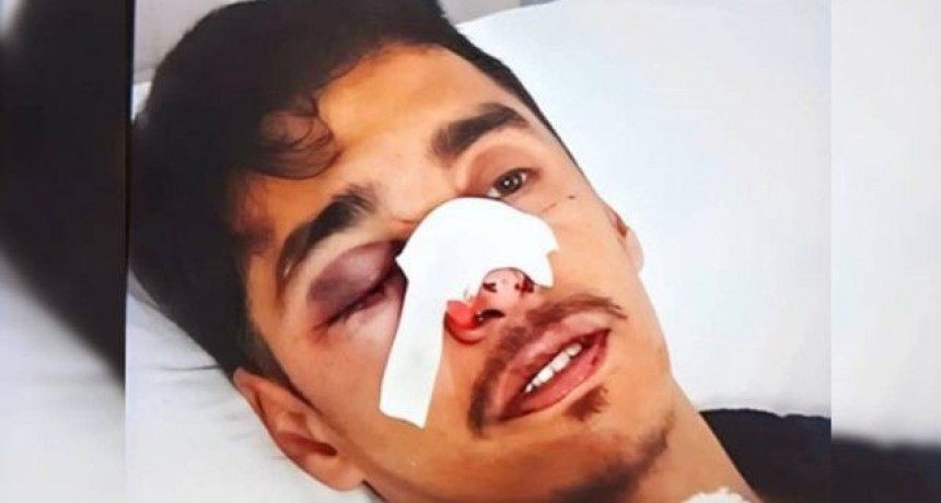 Conmoción en Entre Ríos por la violenta golpiza a un joven hipoacúsico
