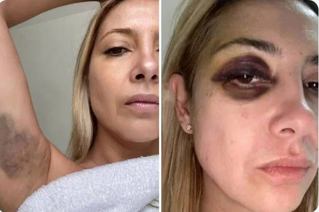  Violencia de género: se conocieron las fotos y chats de la denuncia de Fabiola Yañez contra Alberto Fernández