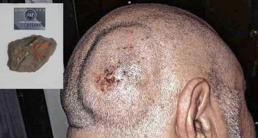 Santa Fe: Chofer de línea 16 agredido con un piedrazo por un pasajero que intentó viajar sin pagar