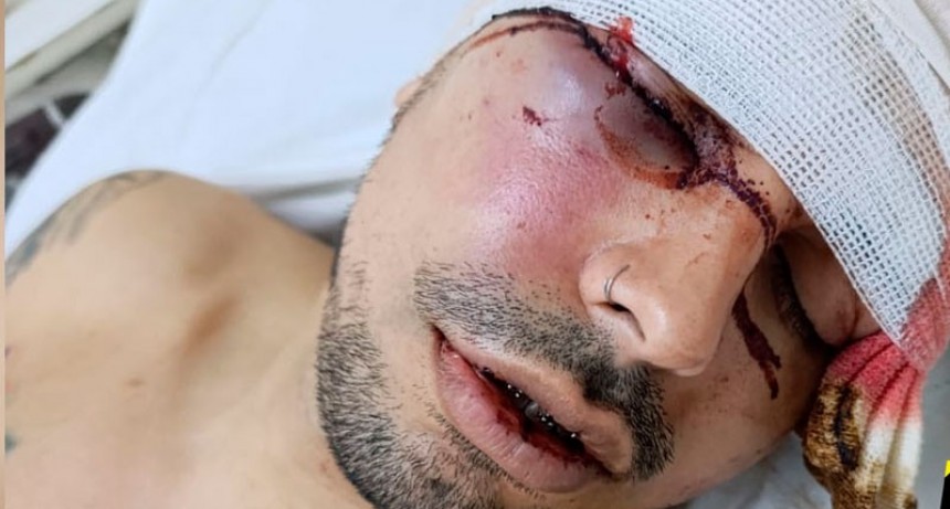 Brutal golpiza a un joven tras una graduación: denuncian falta de seguridad
