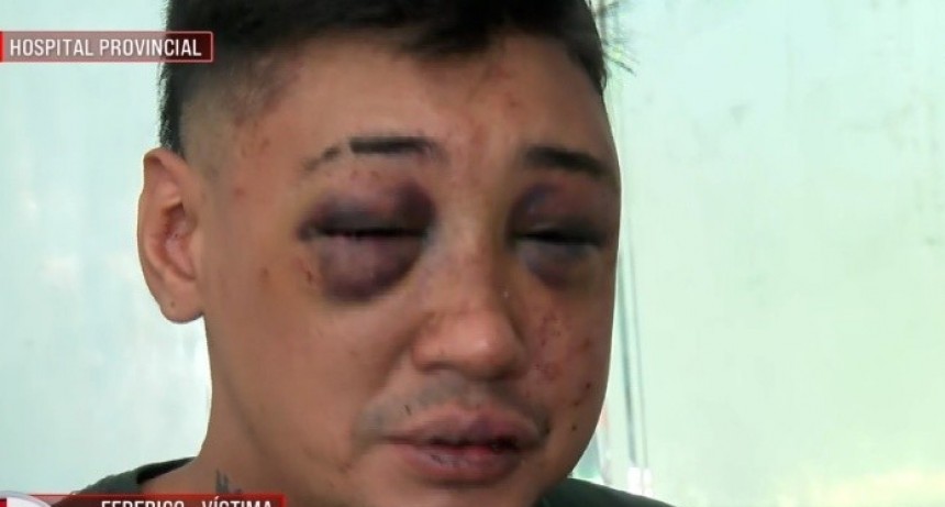 Joven sufrió una brutal golpiza y robo al salir de un cumpleaños de 15